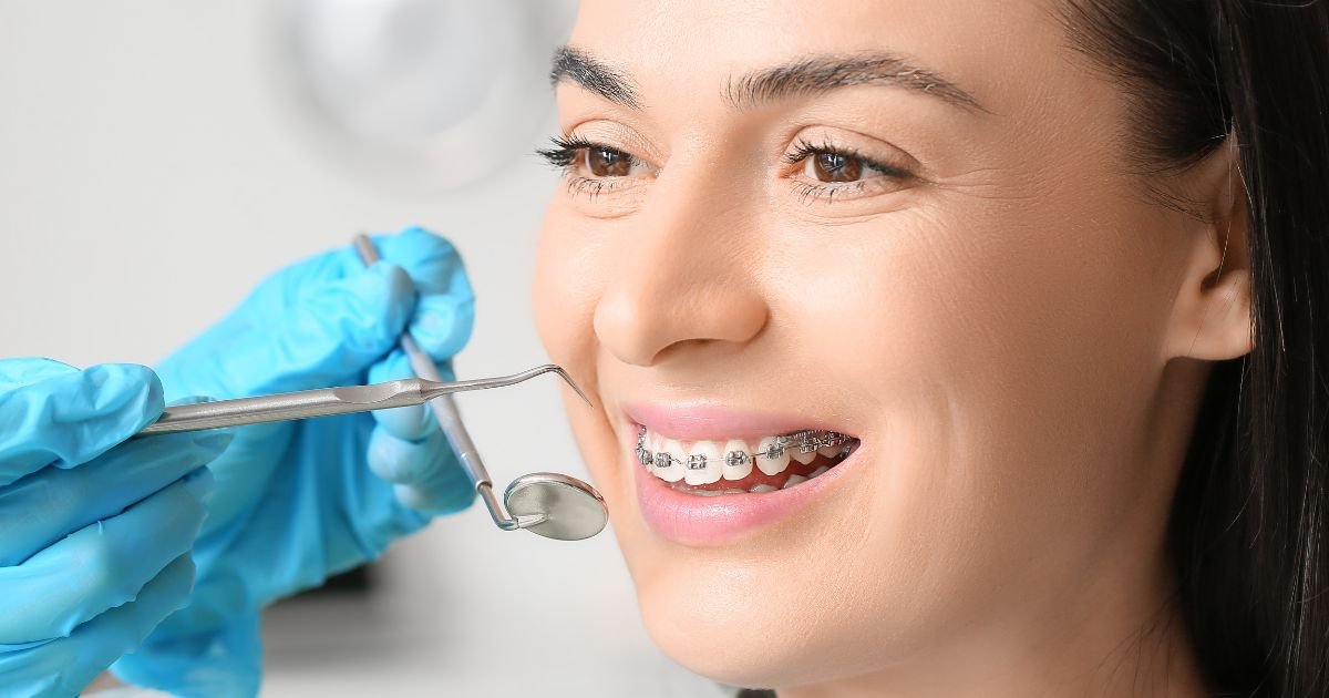 Braces Treatment