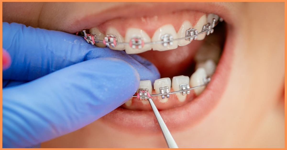 Orthodontist