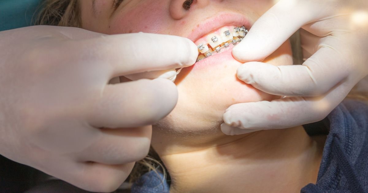 Orthodontist