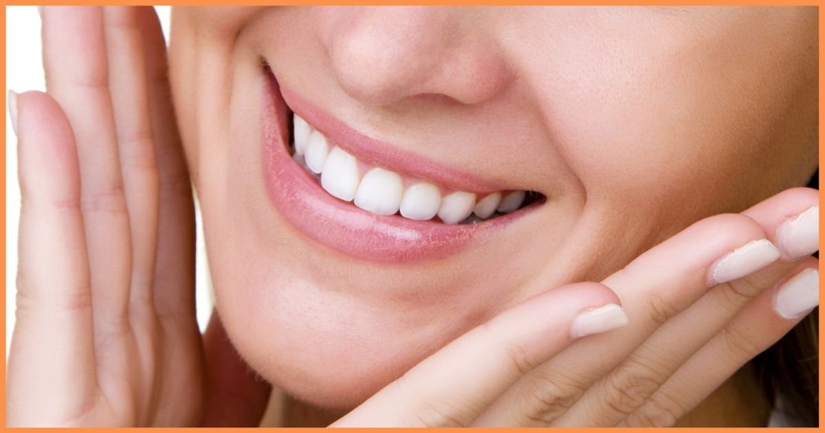 Smile Makeover